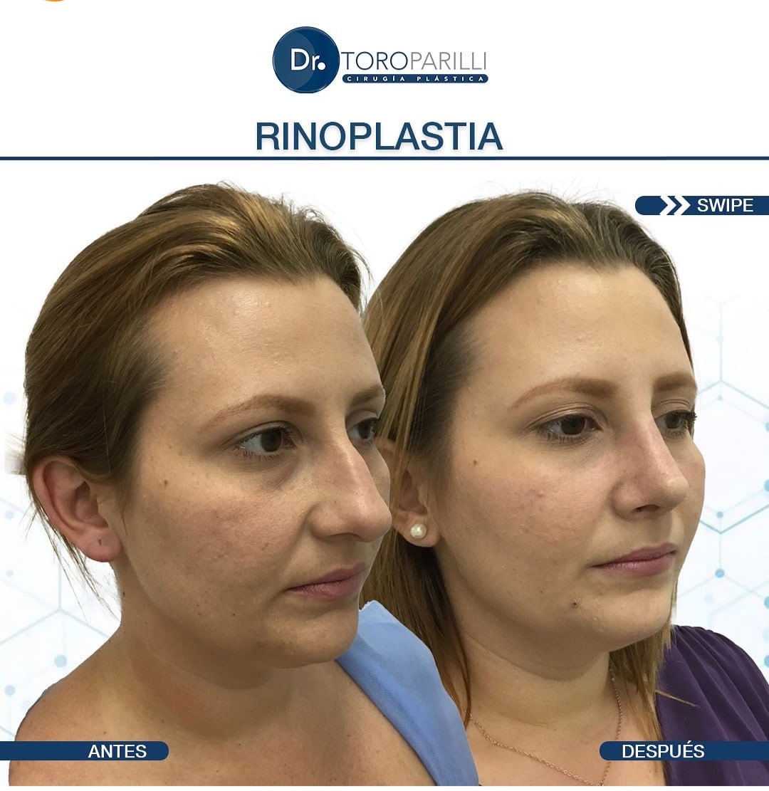 Screenshot_20240424-115423_Instagram