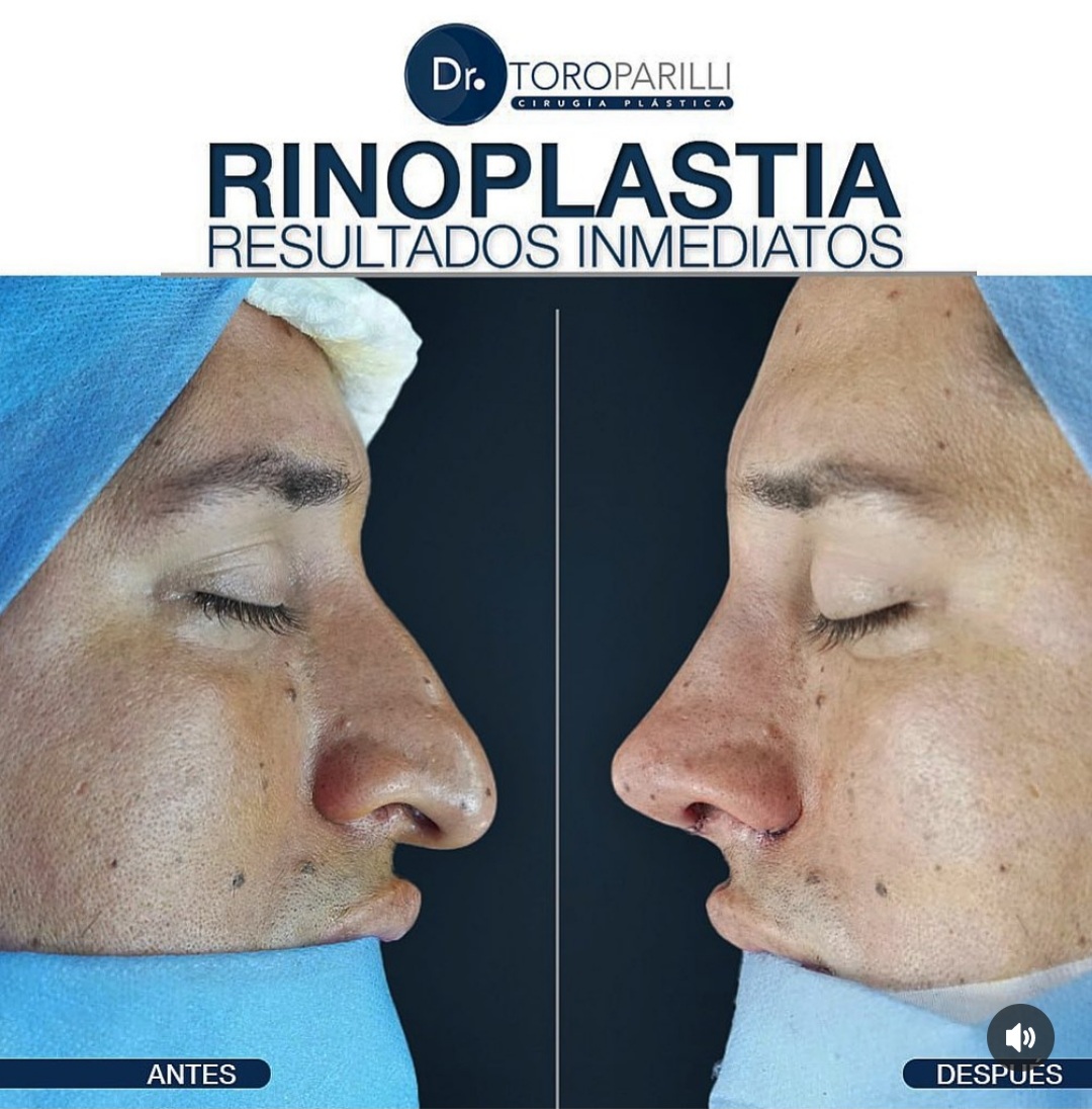 Screenshot_20240424-115441_Instagram