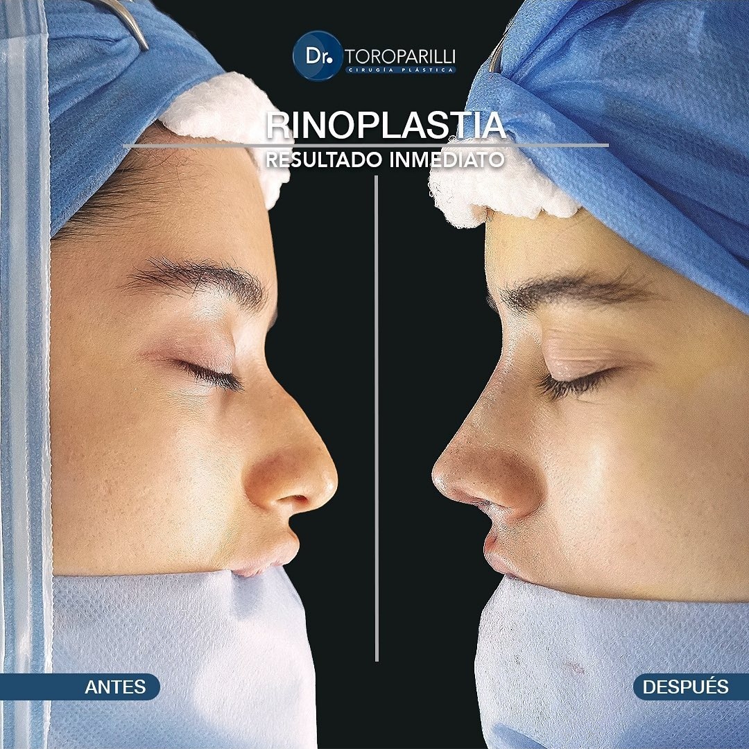 Screenshot_20240424-115644_Instagram